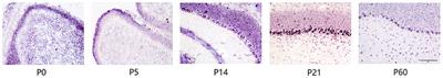 Ankfy1 Is Involved in the Maintenance of Cerebellar Purkinje Cells